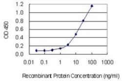 Blood Group B Transferase/GTB/ABO Antibody (1B7), Novus Biologicals 0.1 mg | Buy Online | Novus Biologicals | Fisher Scientific