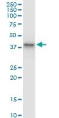 Blood Group B Transferase/GTB/ABO Antibody (1B7), Novus Biologicals 0.1 mg | Buy Online | Novus Biologicals | Fisher Scientific