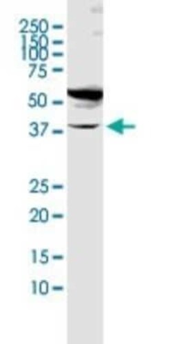 Fucosyltransferase 1/FUT1 Antibody, Novus Biologicals 0.1 mg | Buy Online | Novus Biologicals | Fisher Scientific