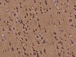 Bmf Antibody, Novus Biologicals 100 &mu;g | Buy Online | Novus Biologicals | Fisher Scientific