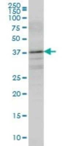 Boll Antibody (5B8), Novus Biologicals 0.1 mg | Buy Online | Novus Biologicals | Fisher Scientific