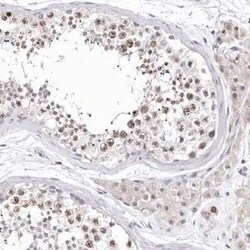 Borealin Antibody, Novus Biologicals:Antibodies:Primary Antibodies