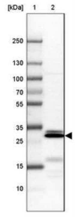 Borealin Antibody, Novus Biologicals:Antibodies:Primary Antibodies
