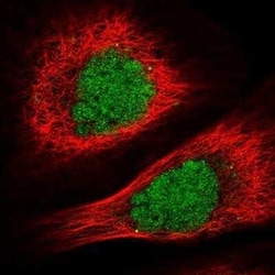 Breast cancer suppressor candidate 1 Antibody, Novus Biologicals 25 &mu;L;