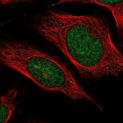 Breast cancer suppressor candidate 1 Antibody, Novus Biologicals 25 &mu;L;