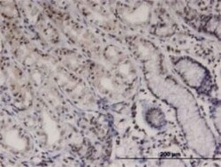 Brk Antibody (2F11), Novus Biologicals 0.1 mg | Buy Online | Novus Biologicals | Fisher Scientific