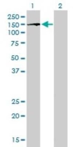 BubR1 Antibody (2G5), Novus Biologicals 0.1 mg | Buy Online | Novus Biologicals | Fisher Scientific