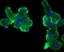 Butyrylcholinesterase/BCHE Rabbit anti-Human, Polyclonal, Novus Biologicals