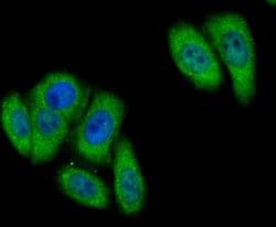 Butyrylcholinesterase/BCHE Rabbit anti-Human, Polyclonal, Novus Biologicals