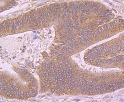 Butyrylcholinesterase/BCHE Rabbit anti-Human, Polyclonal, Novus Biologicals