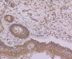 Butyrylcholinesterase/BCHE Rabbit anti-Human, Polyclonal, Novus Biologicals