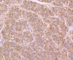 Butyrylcholinesterase/BCHE Rabbit anti-Human, Polyclonal, Novus Biologicals