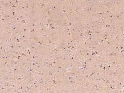 Butyrylcholinesterase/BCHE Antibody, Novus Biologicals:Antibodies:Primary