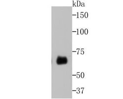 Butyrylcholinesterase/BCHE Rabbit anti-Human, Polyclonal, Novus Biologicals