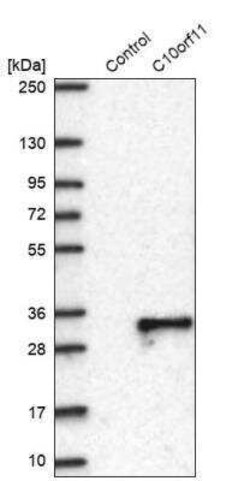 LRMDA Antibody, Novus Biologicals 0.1 mL | Buy Online | Novus Biologicals | Fisher Scientific