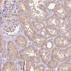 TMEM273 Antibody, Novus Biologicals:Antibodies:Primary Antibodies