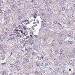 CC2D2B Antibody, Novus Biologicals 25 &mu;L; Unconjugated:Antibodies, Polyclonal
