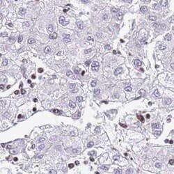 CC2D2B Antibody, Novus Biologicals 25 &mu;L; Unconjugated:Antibodies, Polyclonal