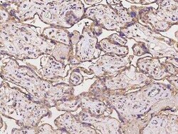C11orf52 Antibody, Novus Biologicals:Antibodies:Primary Antibodies