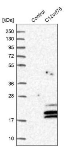 C12orf76 Antibody, Novus Biologicals 25 &mu;L, Unconjugated:Antibodies,