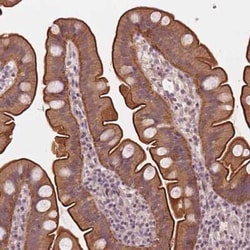 CLBA1 Antibody, Novus Biologicals:Antibodies:Primary Antibodies