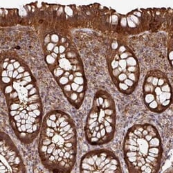 Arpin Antibody, Novus Biologicals:Antibodies:Primary Antibodies