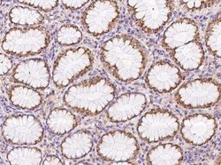 C17orf107 Antibody, Novus Biologicals 100 &mu;g; Unconjugated:Antibodies,