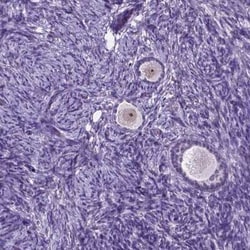 C18orf21 Antibody, Novus Biologicals 0.1 mL, Unconjugated:Antibodies, Polyclonal