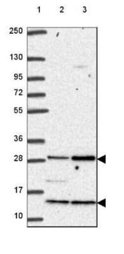 C18orf21 Antibody, Novus Biologicals 0.1 mL, Unconjugated:Antibodies, Polyclonal