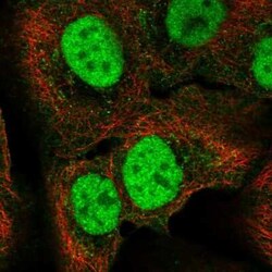 C18orf25 Antibody, Novus Biologicals:Antibodies:Primary Antibodies
