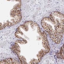 C18orf25 Antibody, Novus Biologicals:Antibodies:Primary Antibodies