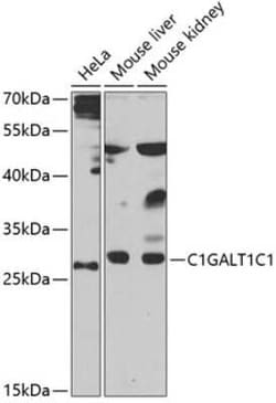 C1GALT1C1 Antibody - BSA Free, Novus Biologicals:Antibodies:Primary Antibodies