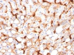 C1QB Antibody (C1QB/2966) - Azide and BSA Free, Novus Biologicals 100 ug;