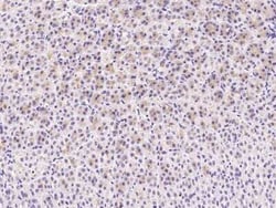 C1QB Antibody, Novus Biologicals 50 &mu;g; Unconjugated:Antibodies, Polyclonal