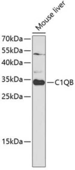 C1QB Antibody - BSA Free, Novus Biologicals 0.1 mL | Buy Online | Novus Biologicals | Fisher Scientific