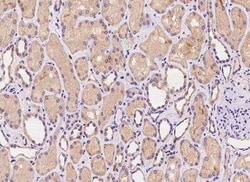 C1orf109 Antibody, Novus Biologicals 50 &mu;g; Unconjugated:Antibodies,