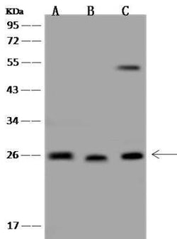 C1orf109 Antibody, Novus Biologicals 50 &mu;g; Unconjugated:Antibodies,
