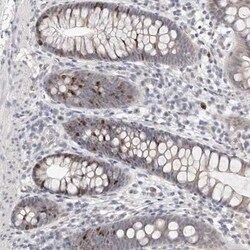 CCDC190 Antibody, Novus Biologicals 25 &mu;L | Buy Online | Novus Biologicals | Fisher Scientific
