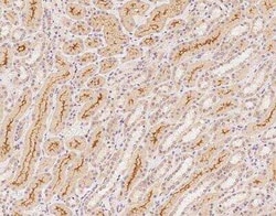 C1orf198 Antibody, Novus Biologicals:Antibodies:Primary Antibodies