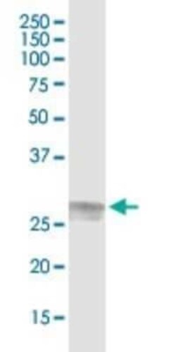 C1q Antibody, Novus Biologicals 0.1 mL; Unconjugated:Antibodies, Polyclonal