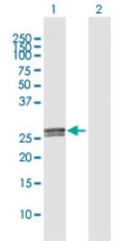 C1q Antibody, Novus Biologicals 0.1 mL; Unconjugated:Antibodies, Polyclonal
