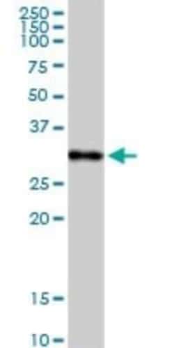 C1q Antibody, Novus Biologicals 0.1 mg | Buy Online | Novus Biologicals | Fisher Scientific