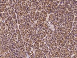 C20orf96 Antibody, Novus Biologicals 50 &mu;g, Unconjugated:Antibodies,