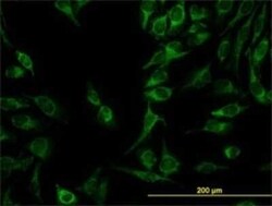 GATD3A Antibody (1F5), Novus Biologicals 0.1 mg | Buy Online | Novus Biologicals | Fisher Scientific