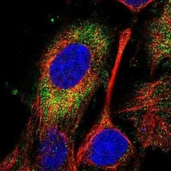 SPATC1L Antibody, Novus Biologicals:Antibodies:Primary Antibodies