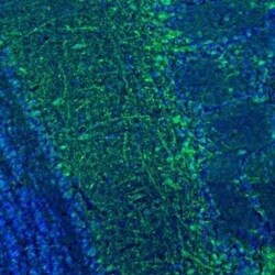 C21orf59 Antibody, Novus Biologicals 0.1 mL; Unconjugated:Antibodies, Polyclonal