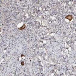 C21orf59 Antibody, Novus Biologicals 0.1 mL; Unconjugated:Antibodies, Polyclonal