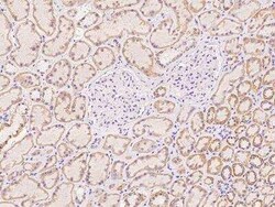C21orf62 Antibody, Novus Biologicals:Antibodies:Primary Antibodies