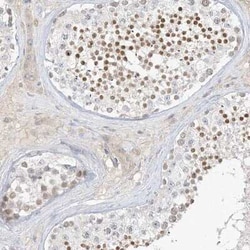 C2orf42 Antibody, Novus Biologicals:Antibodies:Primary Antibodies