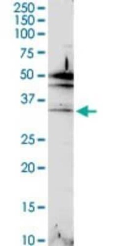MAIP1 Antibody, Novus Biologicals 0.1 mg | Buy Online | Novus Biologicals | Fisher Scientific